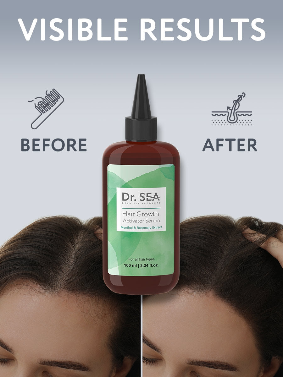 Hair Growth Activator Serum With Menthol & Rosemary Extract - 100 ml